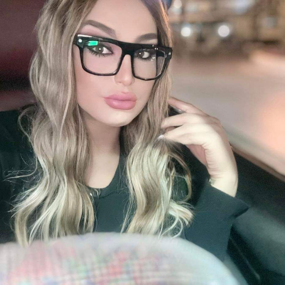 Want To Find Escorts in Clermont-Ferrand, France👀? Try Orhidi Right Now!